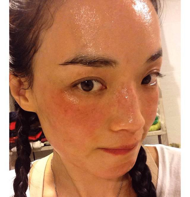 What should we do when seasonal skin problems increase?
